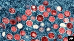 美国国家过敏及感染疾病研究院公布的猴痘(Monkeypox)病毒的彩色照片。-美联社资料照