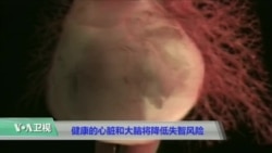 健康的心脏和大脑将降低失智风险 健康的心脏和大脑将降低失智风险