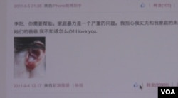 李金将自己被家暴后的瘀青照片贴到网上(VOA视频截图)