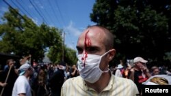 美国维吉尼亚州夏洛特维尔爆发白人至上主义者与反示威者的冲突,一名男子受伤。(2017年8月12日)