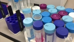 肌肉干细胞在老化和受伤方面反应不同 肌肉干细胞在老化和受伤方面反应不同