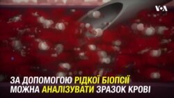 Аналіз крові здатний ідентифікувати тих жінок, які є більш схильними до рецидиву раку молочної залози. Відео Аналіз крові здатний ідентифікувати тих жінок, які є більш схильними до рецидиву раку молочної залози. Відео