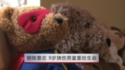 钢铁意志 9岁烧伤男童重拾生命 钢铁意志 9岁烧伤男童重拾生命