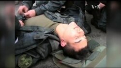 Польова медицина досі на плечах волонтерів та Діаспори. Відео. Польова медицина досі на плечах волонтерів та Діаспори. Відео.
