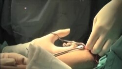 激光技术弥合伤口,天衣无缝不留痕 激光技术弥合伤口,天衣无缝不留痕