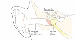 Điếc sau khi chấn thương đầu Điếc sau khi chấn thương đầu
