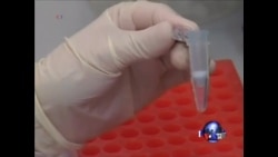 禽流感可能人际传染引发担忧 禽流感可能人际传染引发担忧